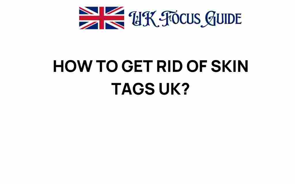 how-to-get-rid-of-skin-tags-uk